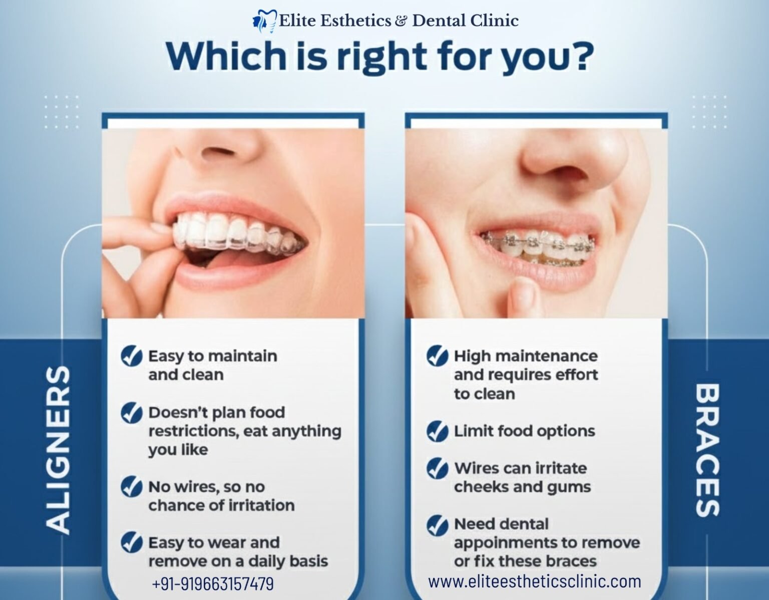 Clear Aligners vs Traditional Braces – Which Is Better? - Elite ...